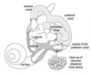 BPPV, vestibular apparatus